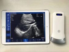 Digital Portable Ultrasound Equipment Linear/Convex Probe ios Andriod picture