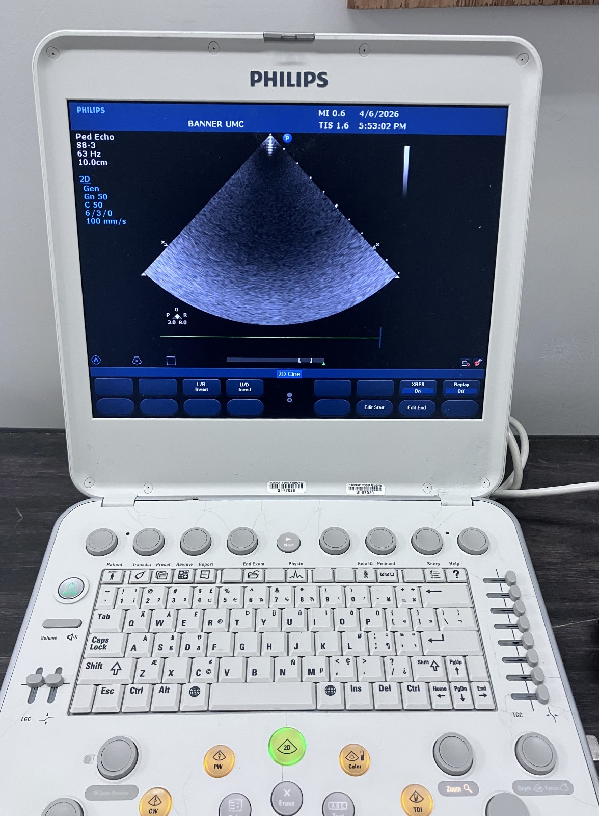 2014 Philips CX50 Portable Ultrasound with S8-3 Transducer Probe