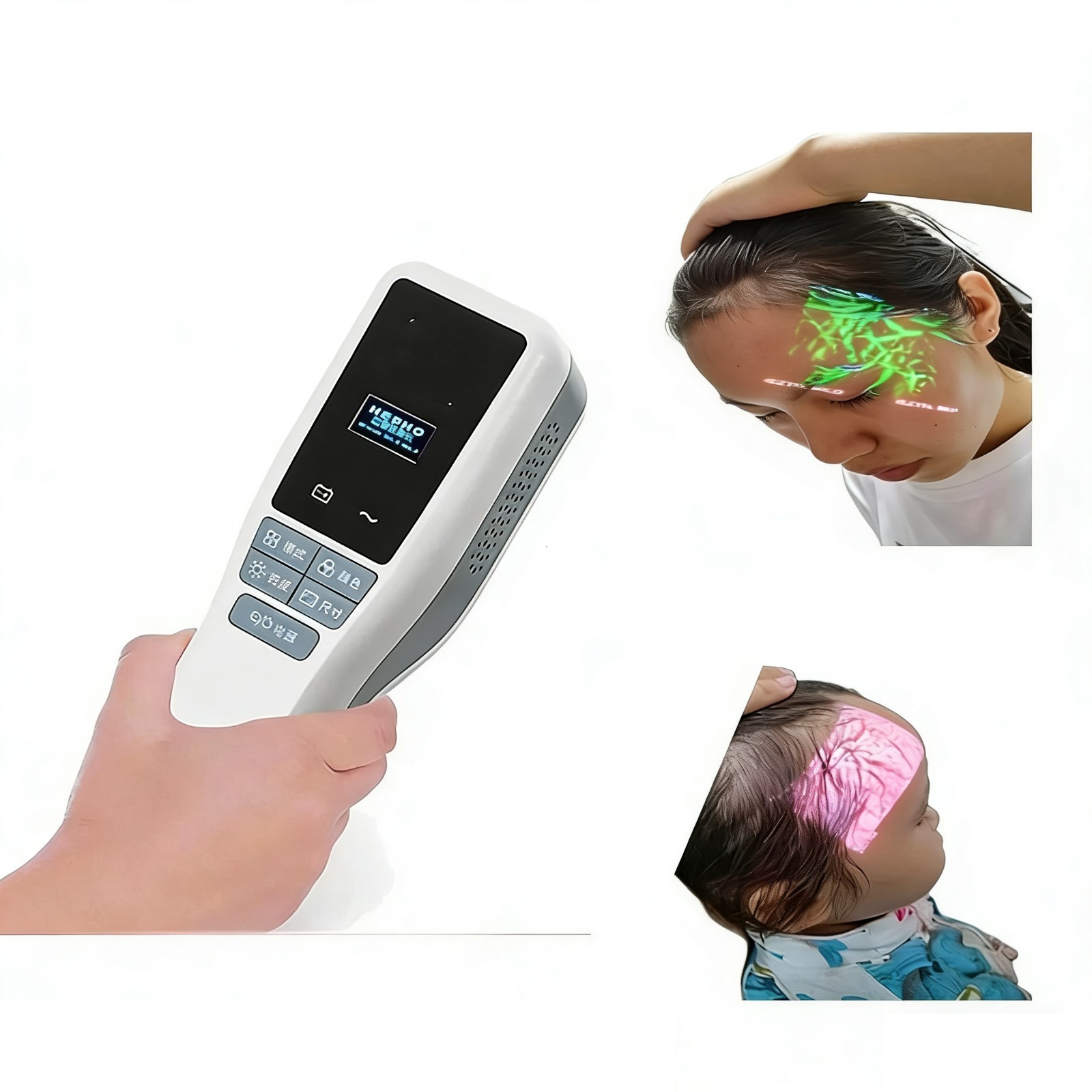 Medical Vein Finder - Handheld Infrared Device for Blood Draws & IV Insertion