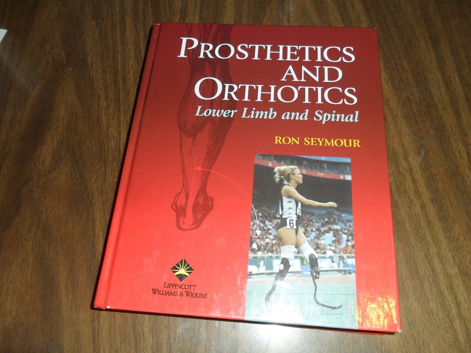 Prosthetics and Orthotics: Lower Limb and Spine Prosthetics and Orthotics: Lower Limb and Spine