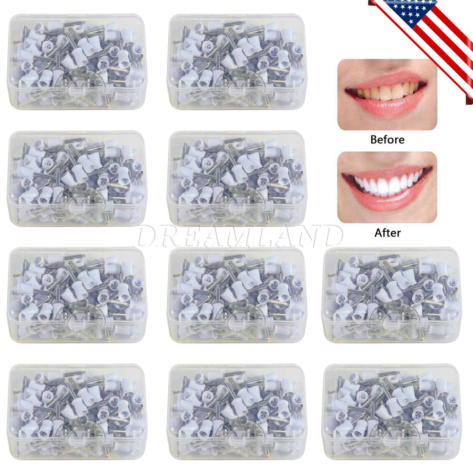 1000pcs Dental Prophy Polishing Cup Cups For Contra Angle Handpiece Latch CE