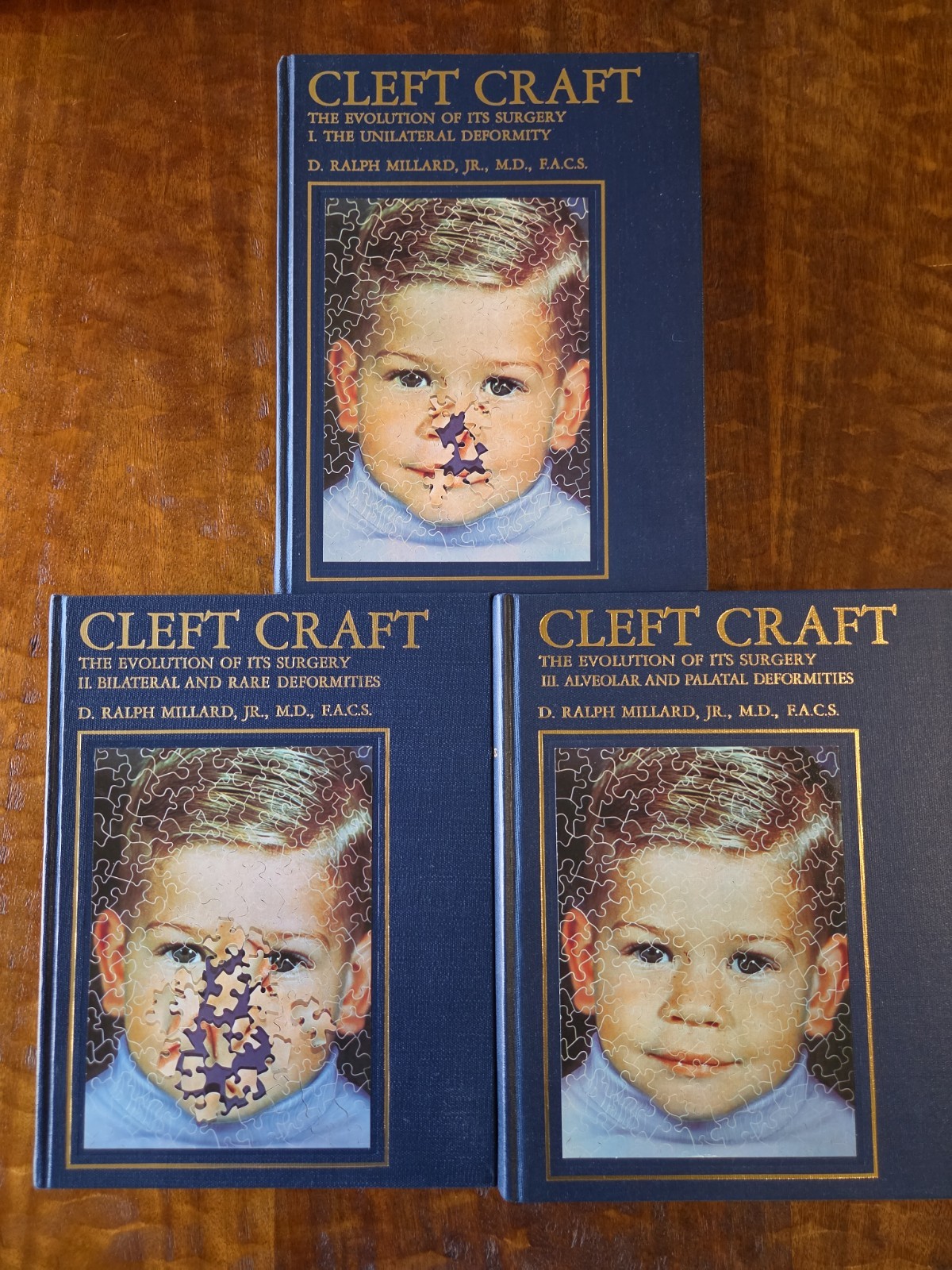Cleft Craft Vol 1–3 by D. Ralph Millard MD Plastic Surgery Medical Textbook Set