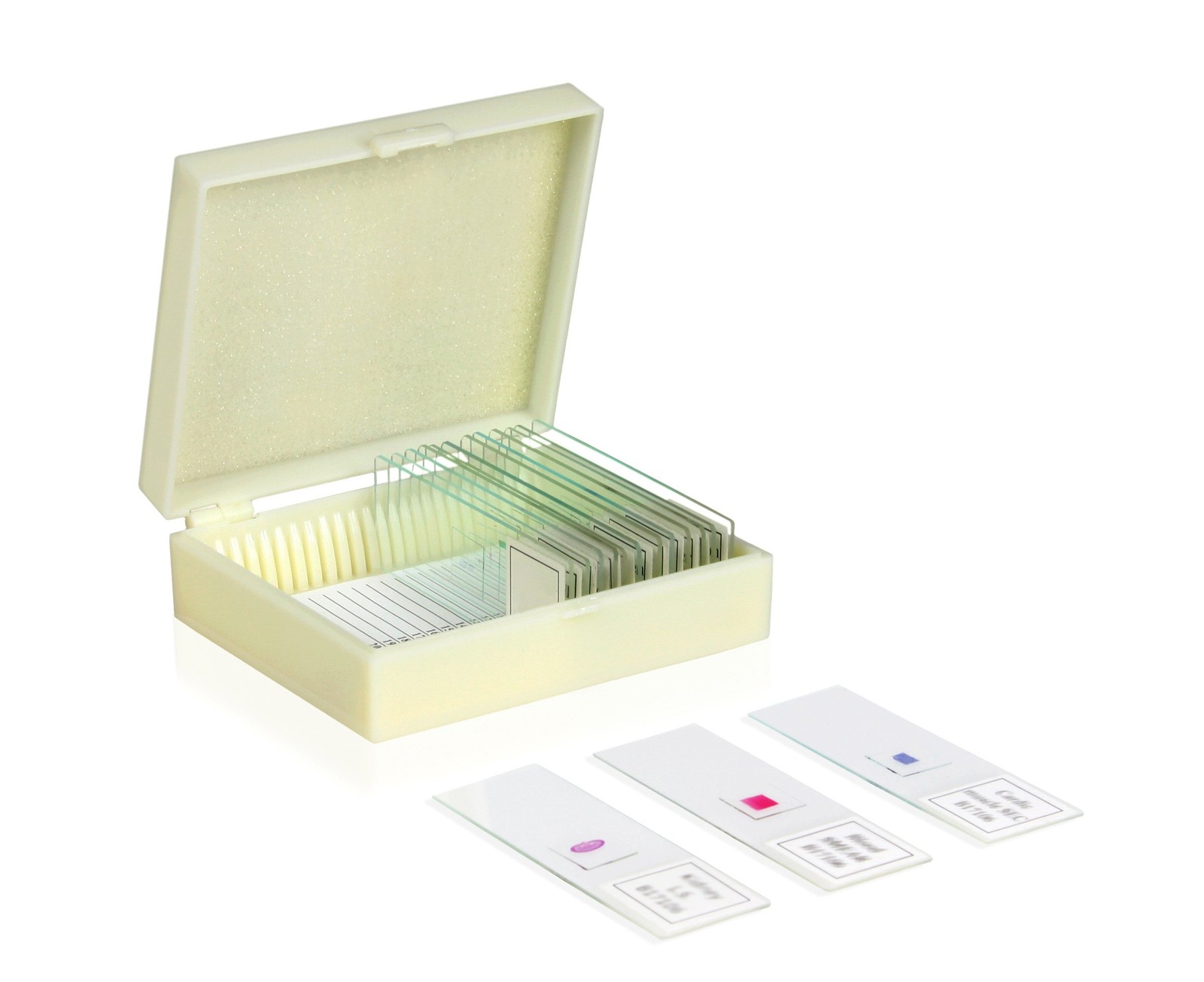 Vision Scientific VSH116 Prepared Slide Set – Deadly Human Diseases Set of 10...