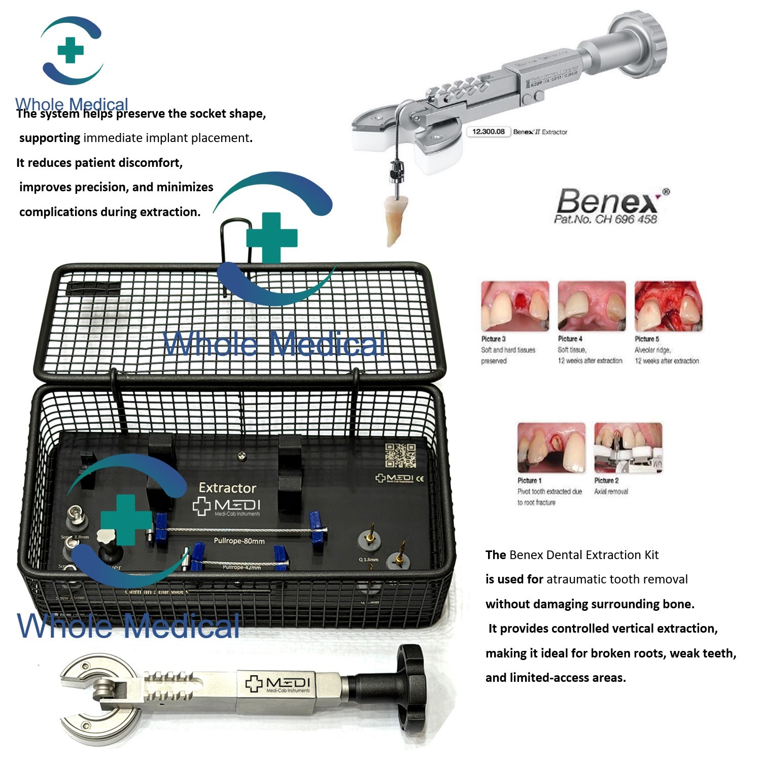 BENEX Extraction System Full Kit for Atraumatic Tooth Removal Dental Instrumet