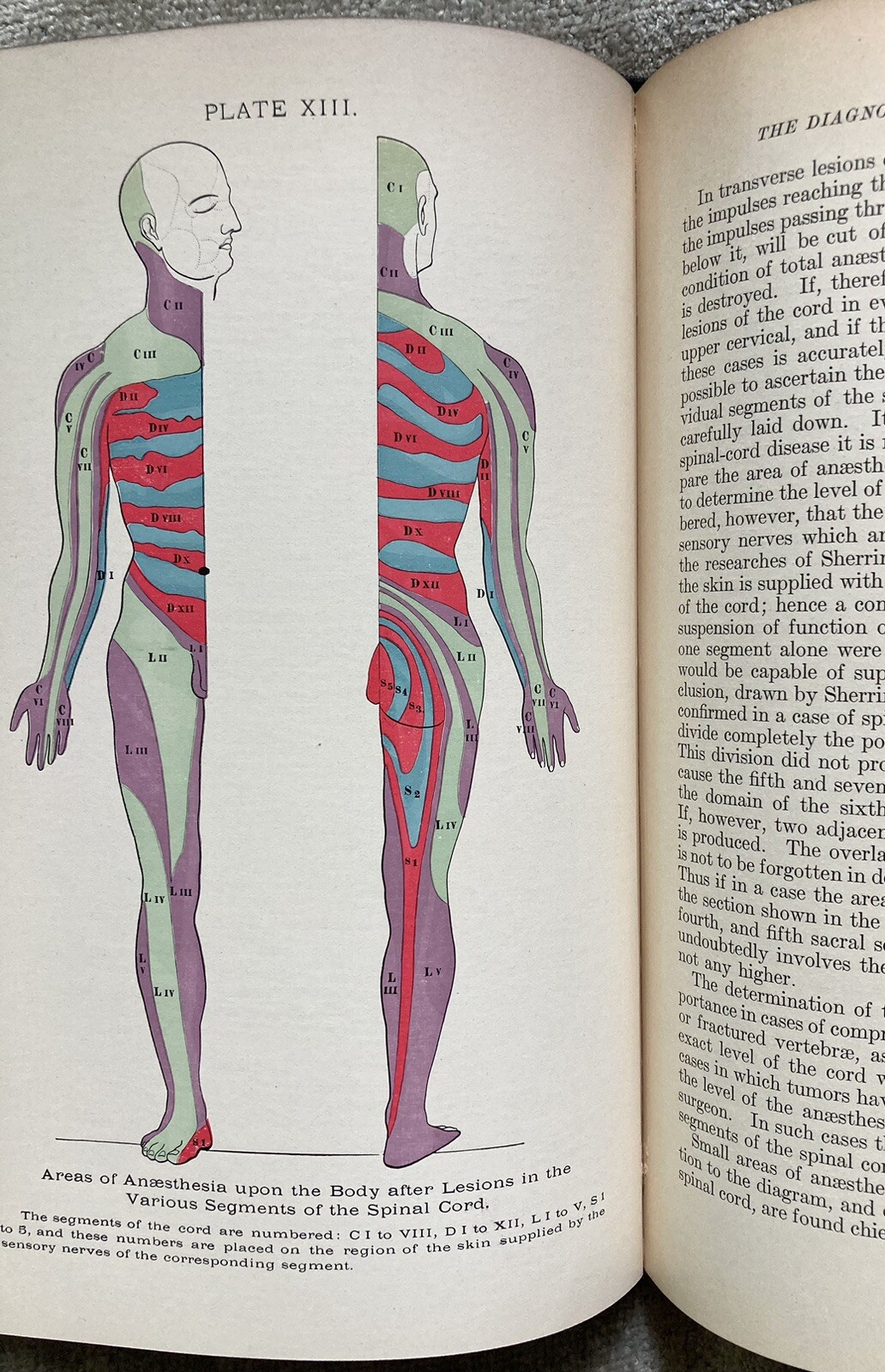 Organic Nervous Diseases, Early Neurology, Collectable, 1st. Ed., Starr, 1903