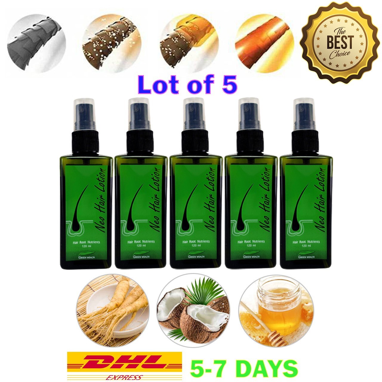 5x Original Neo Hair Lotion Hair Regrowth Serum Spray Root Treatment Nutrients G