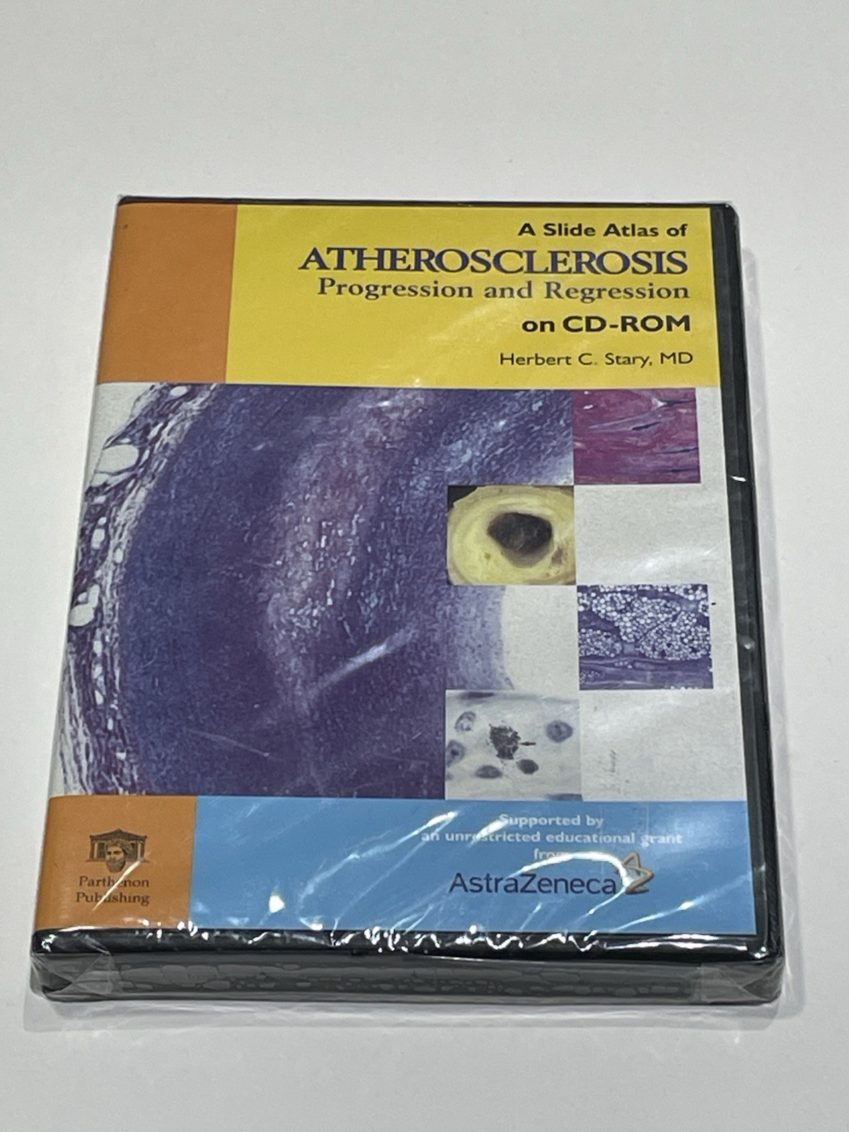 An Atlas of Atherosclerosis Progression and Regression CD-ROM Herbert Stary