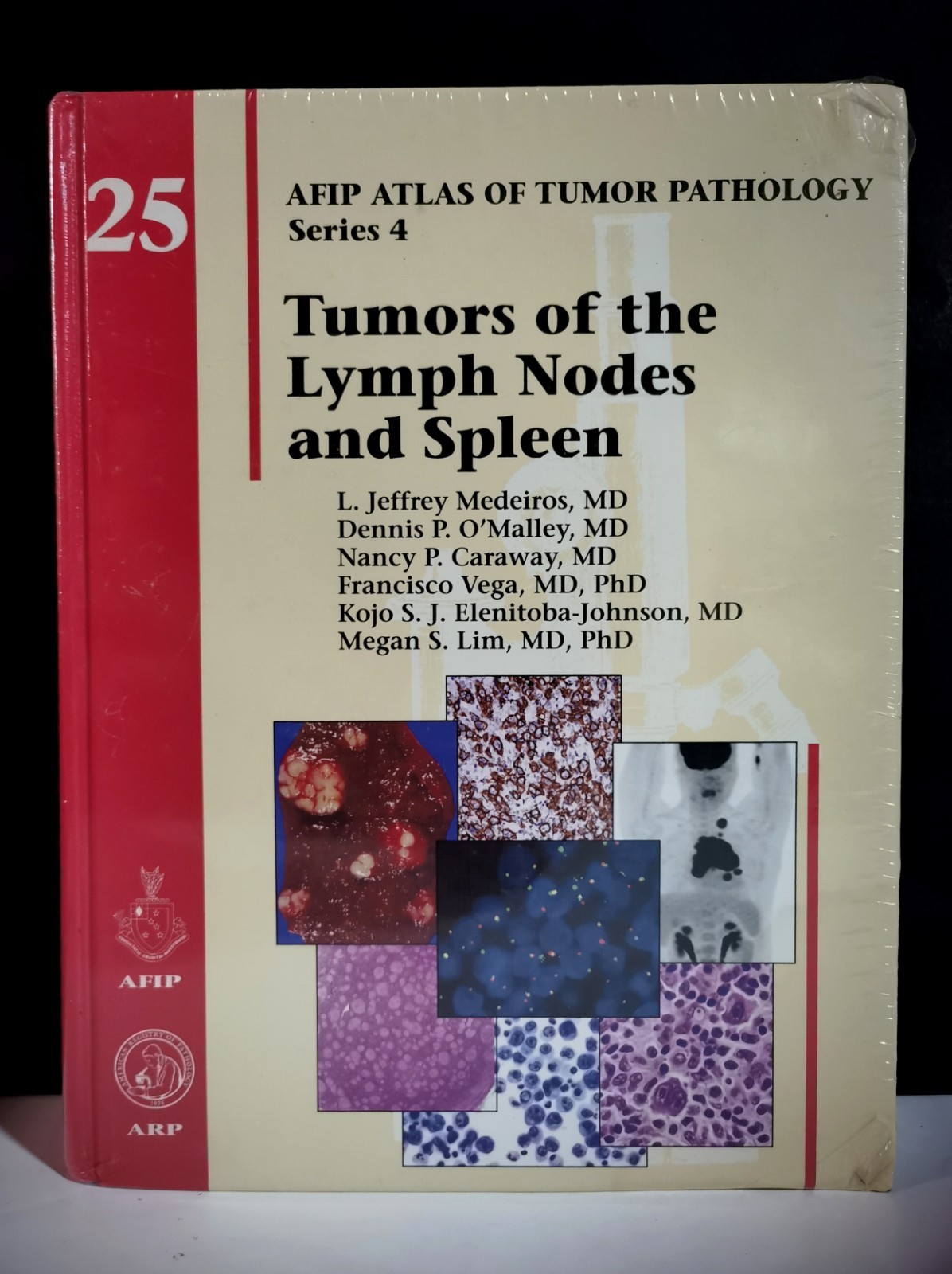 Tumors of the Lymph Nodes and Spleen AFIP Atlas of Tumor Pathology Series 4 NEW Tumors of the Lymph Nodes and Spleen AFIP Atlas of Tumor Pathology Series 4 NEW