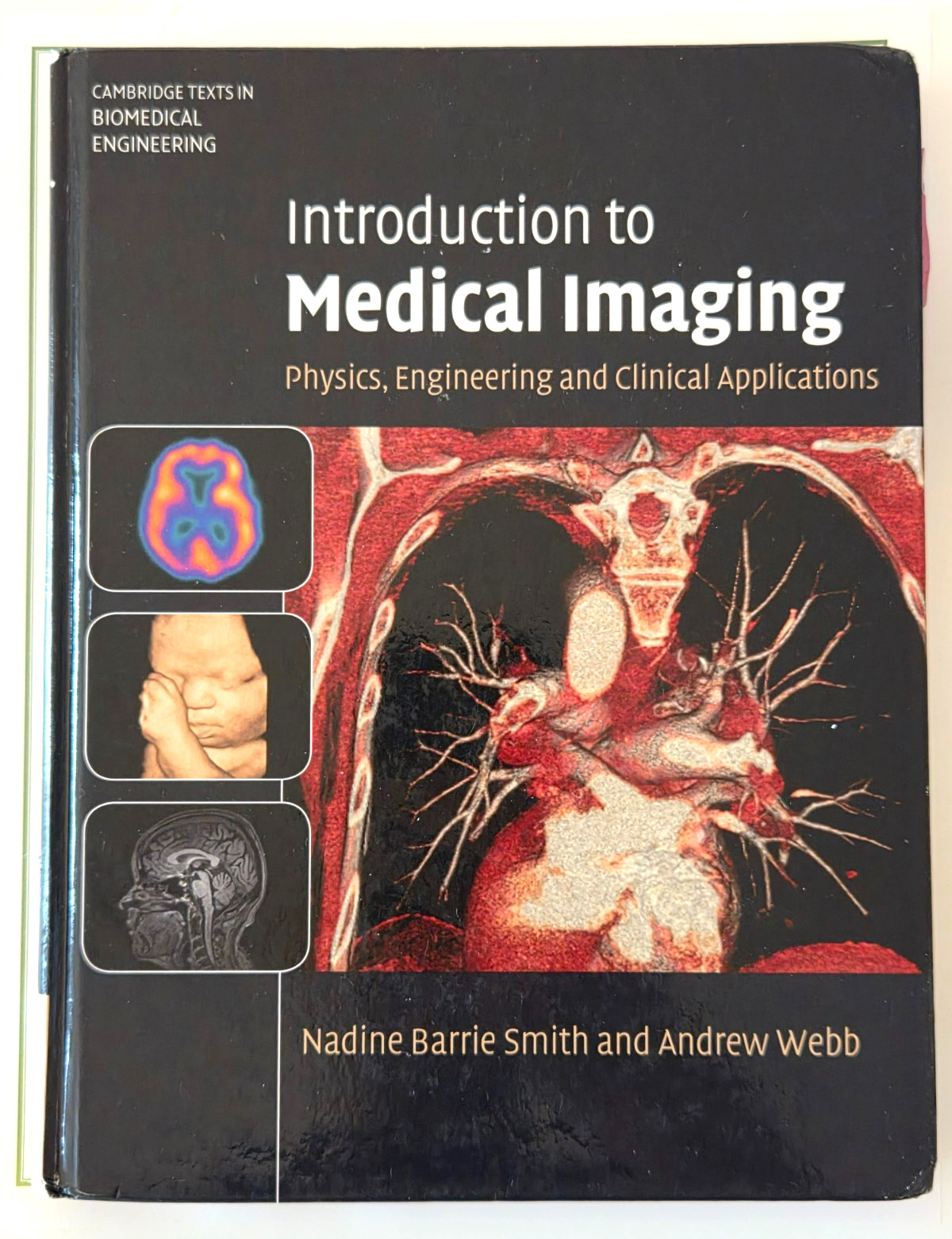Introduction to Medical Imaging Cambridge Texts Smith Webb