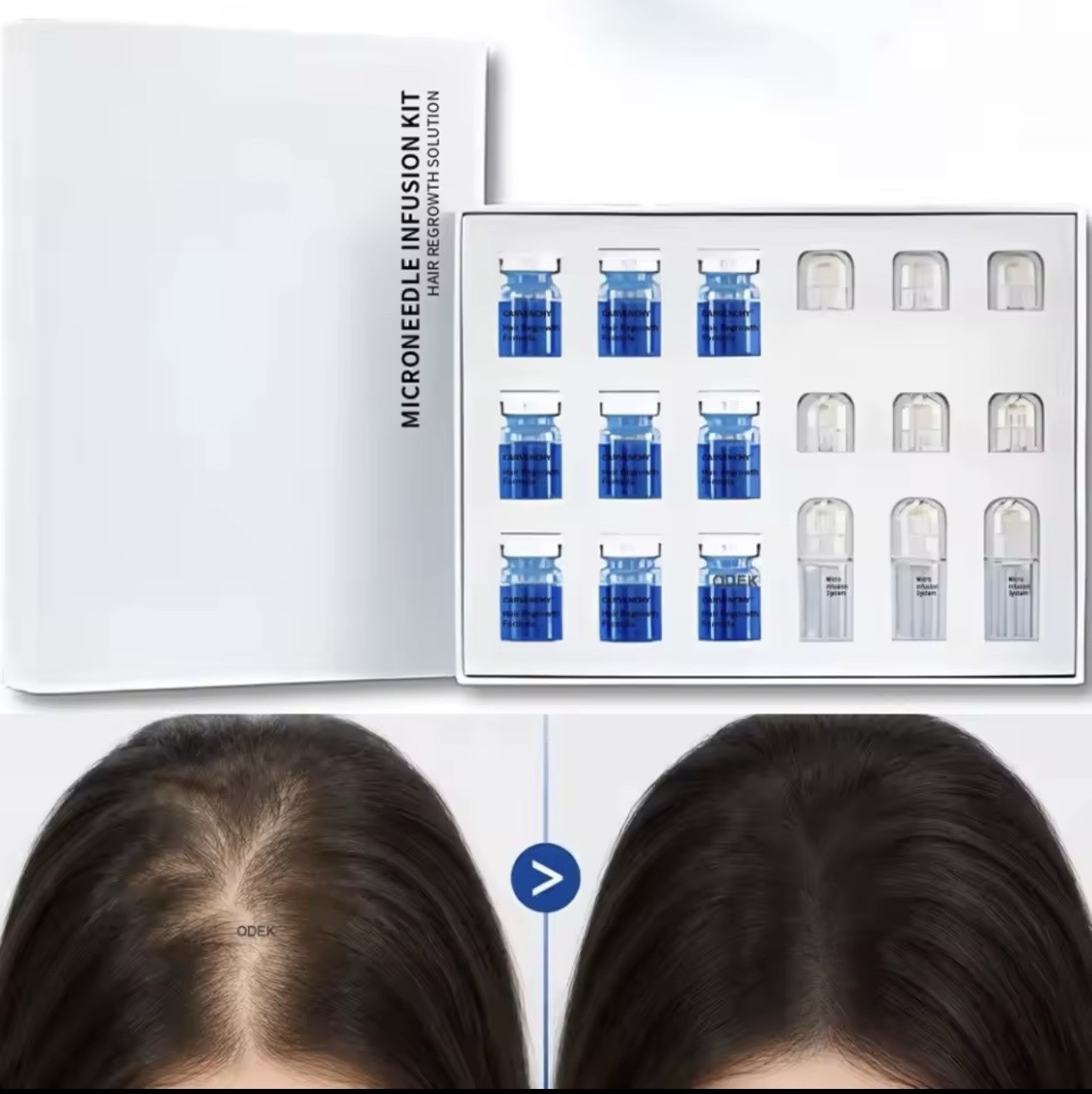 Peptonix copper peptide serum For Fuller Hair & Healthy Scalp. 3 Month Supply.