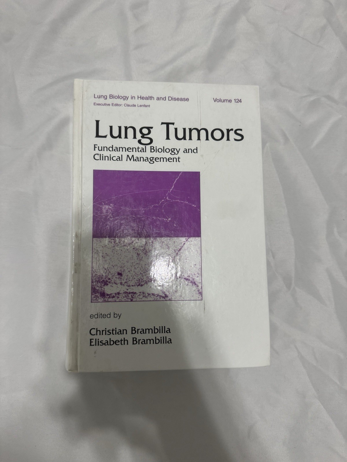 Lung Tumors: Fundamental Biology and Clinical Management (Lung Biology in Health