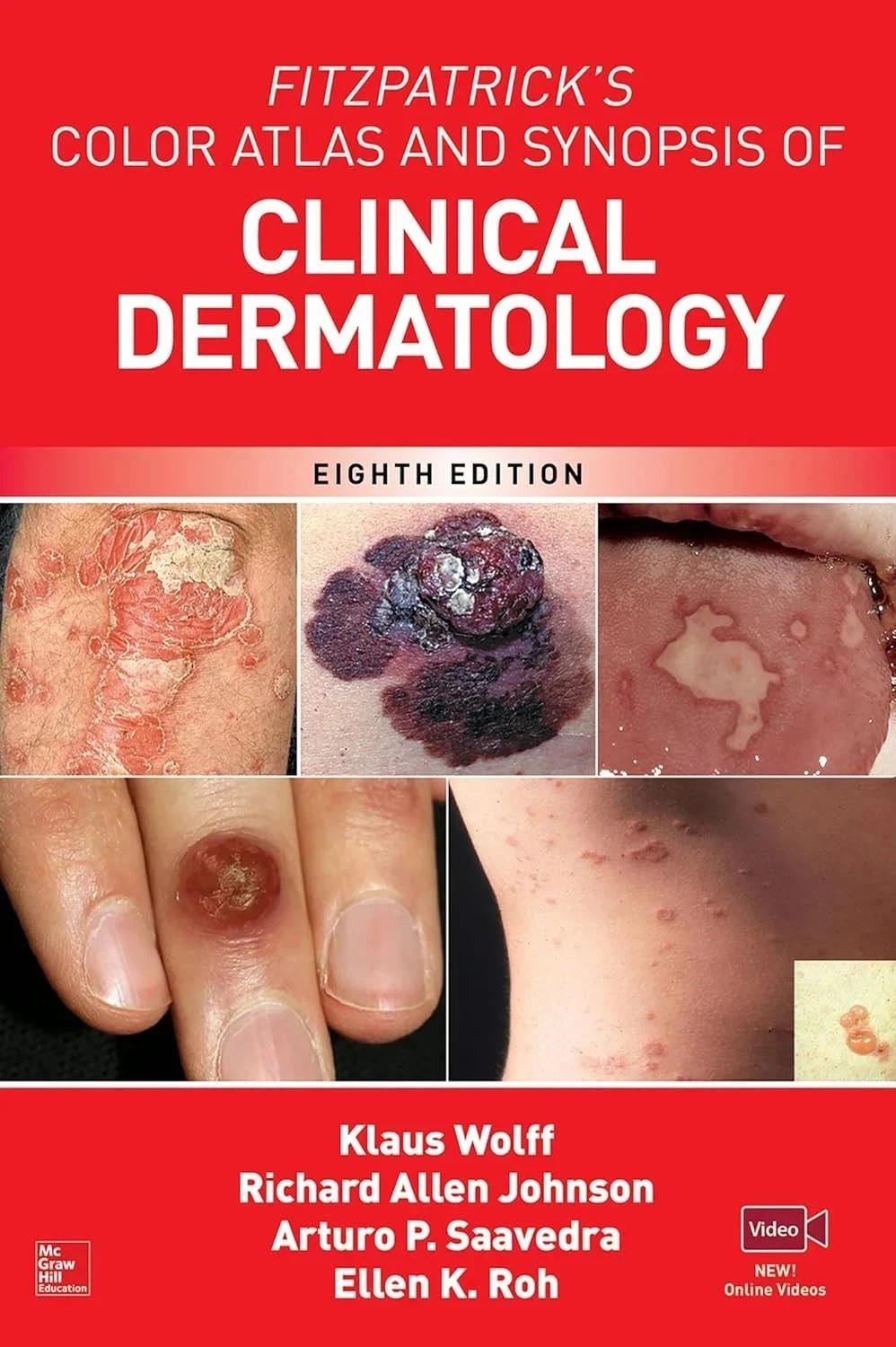 Fitzpatrick\'s Color Atlas AND SYNOPSIS OF CLINICAL DERMATOLOGY, 8th Ed Fitzpatrick\'s Color Atlas AND SYNOPSIS OF CLINICAL DERMATOLOGY, 8th Ed