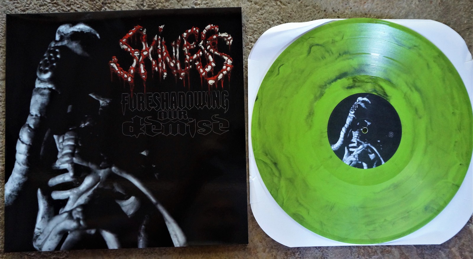 Skinless-Foreshadowing Our Demise LP Toxic Green Cannibal Corpse,Mortician,Vile Skinless-Foreshadowing Our Demise LP Toxic Green Cannibal Corpse,Mortician,Vile