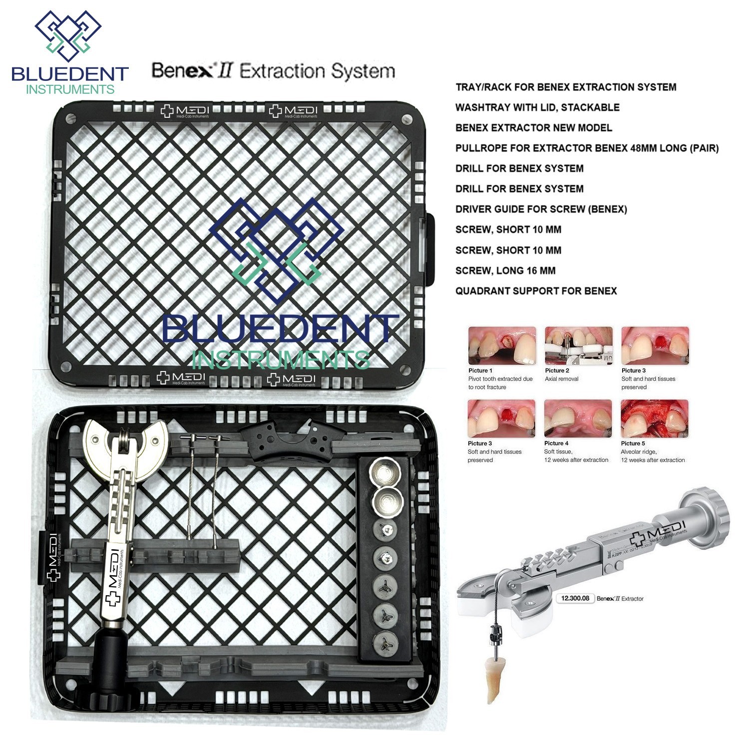 BENEX II Dental Extraction System Full Kit Atraumatic Tooth Removal Instruments