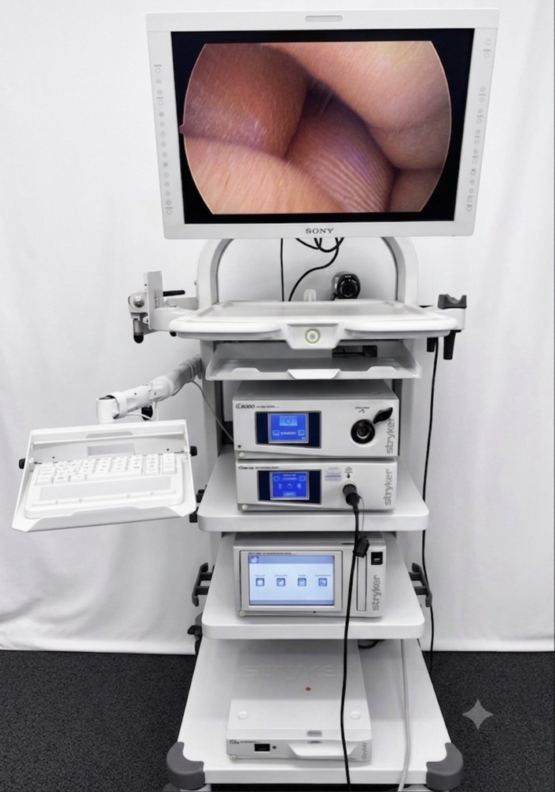 Stryker 1288 HD Laparoscopy / Endoscope System with Camera Stryker 1288 HD Laparoscopy / Endoscope System with Camera