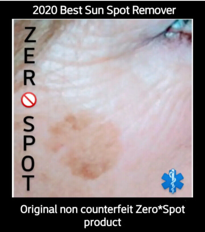 Sun spot , Age Spot Corrector, Dark Spot Remover Treatment anti aging solution