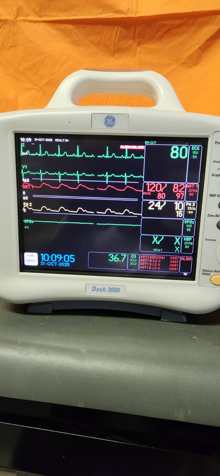 GE DASH 3000 Patient Monitor GE DASH 3000 Patient Monitor