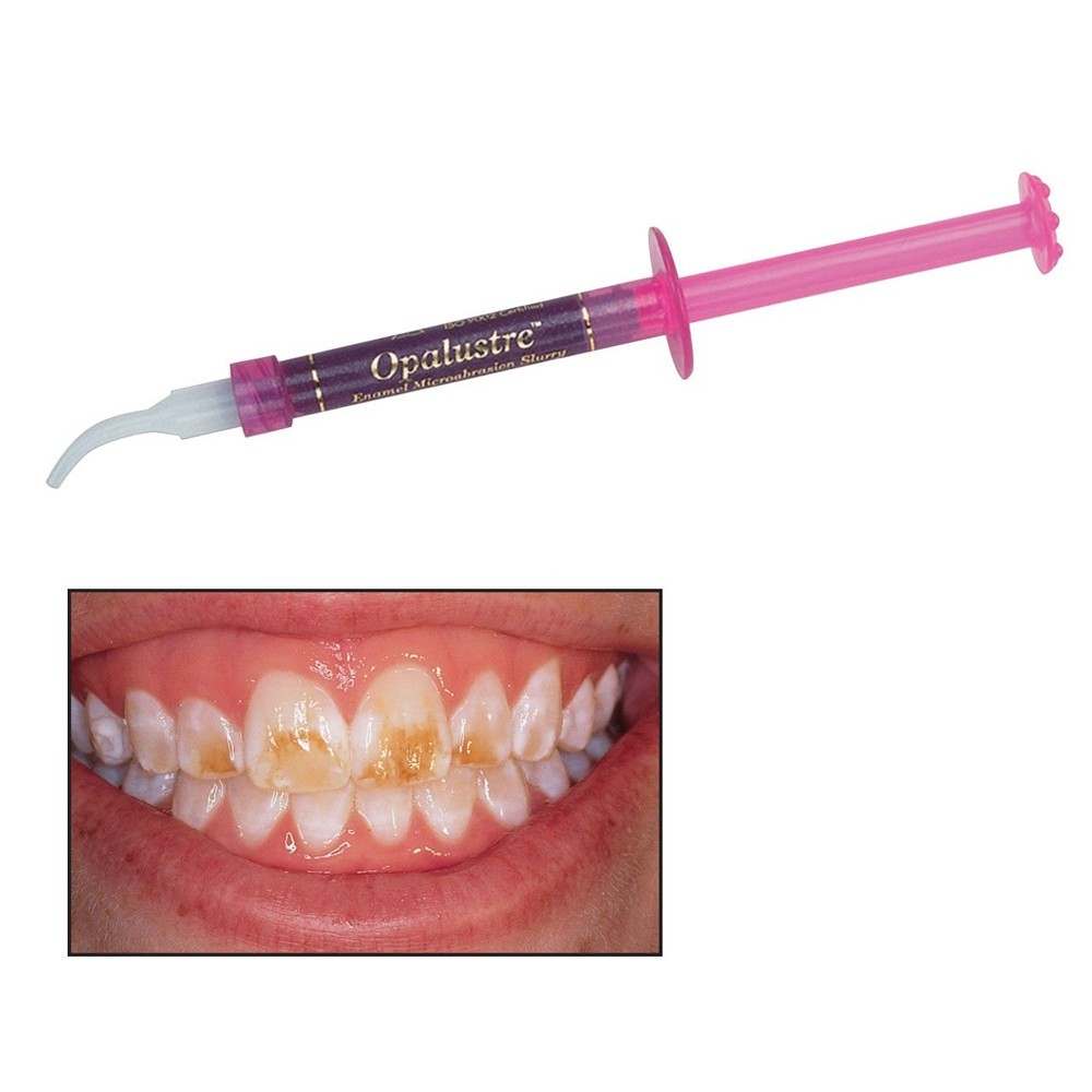 New Dental Ultradent Opalustre  for stain removal  1.2 mL Syringe