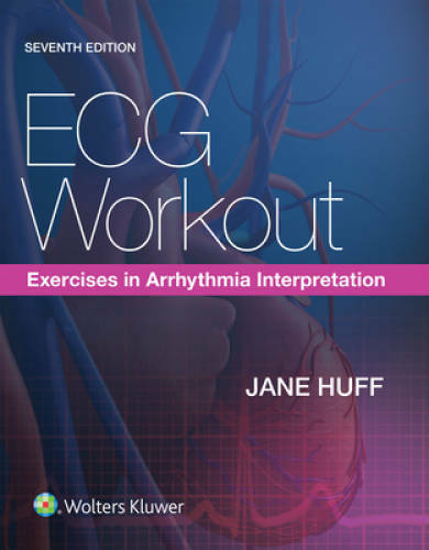 ECG Workout: Exercises in Arrhythmia Interpretation - Paperback - GOOD
