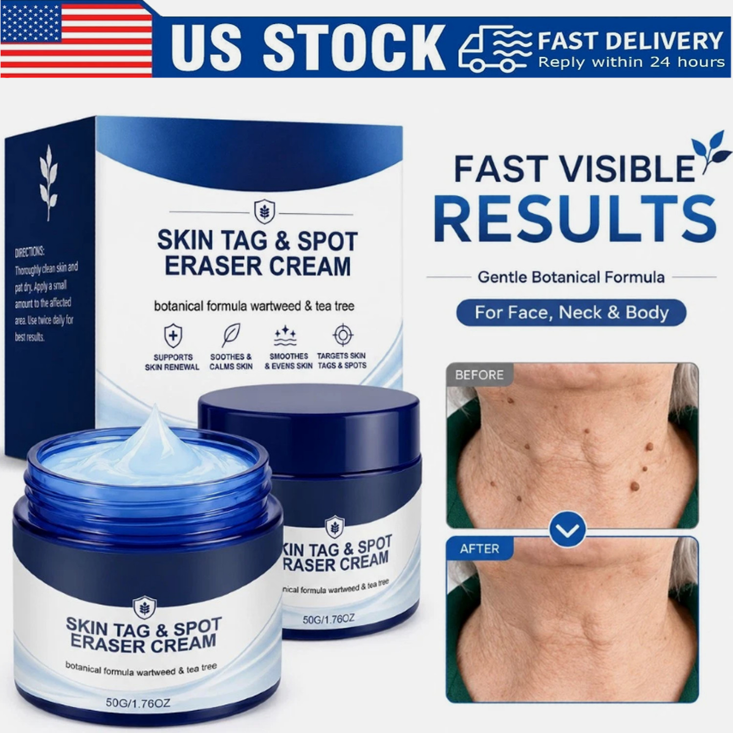 Picdo 7-Day Skin Tag Spot Eraser Cream, Advanced Imperfection Removal Cream