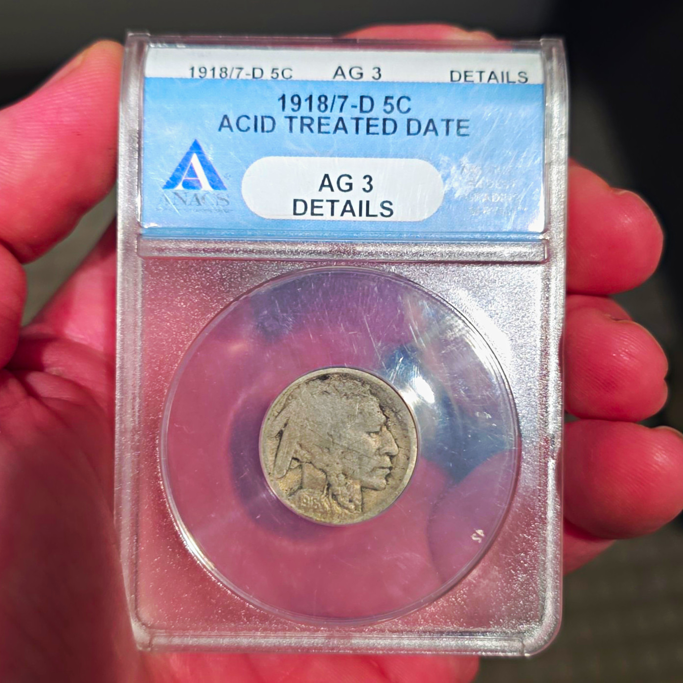 1918/7-D Buffalo 5C Nickel Overdate Acid Treated Date ANACS AG 3 FULL DATE 1918/7-D Buffalo 5C Nickel Overdate Acid Treated Date ANACS AG 3 FULL DATE