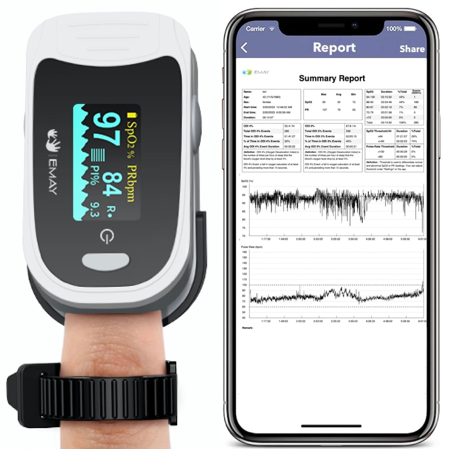 EMAY EMO-80 Sleep Oxygen Monitor with Built-in Recording Capability