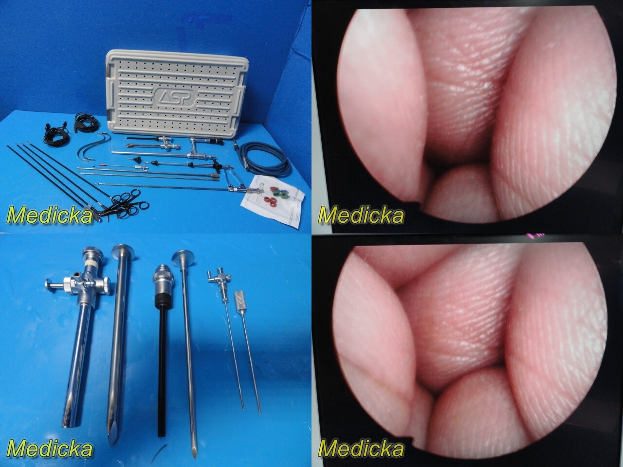 Olympus A5306 10mmx0° Operating Laparoscope W/ Instrument Set (GYN,Uro) ~ 27972