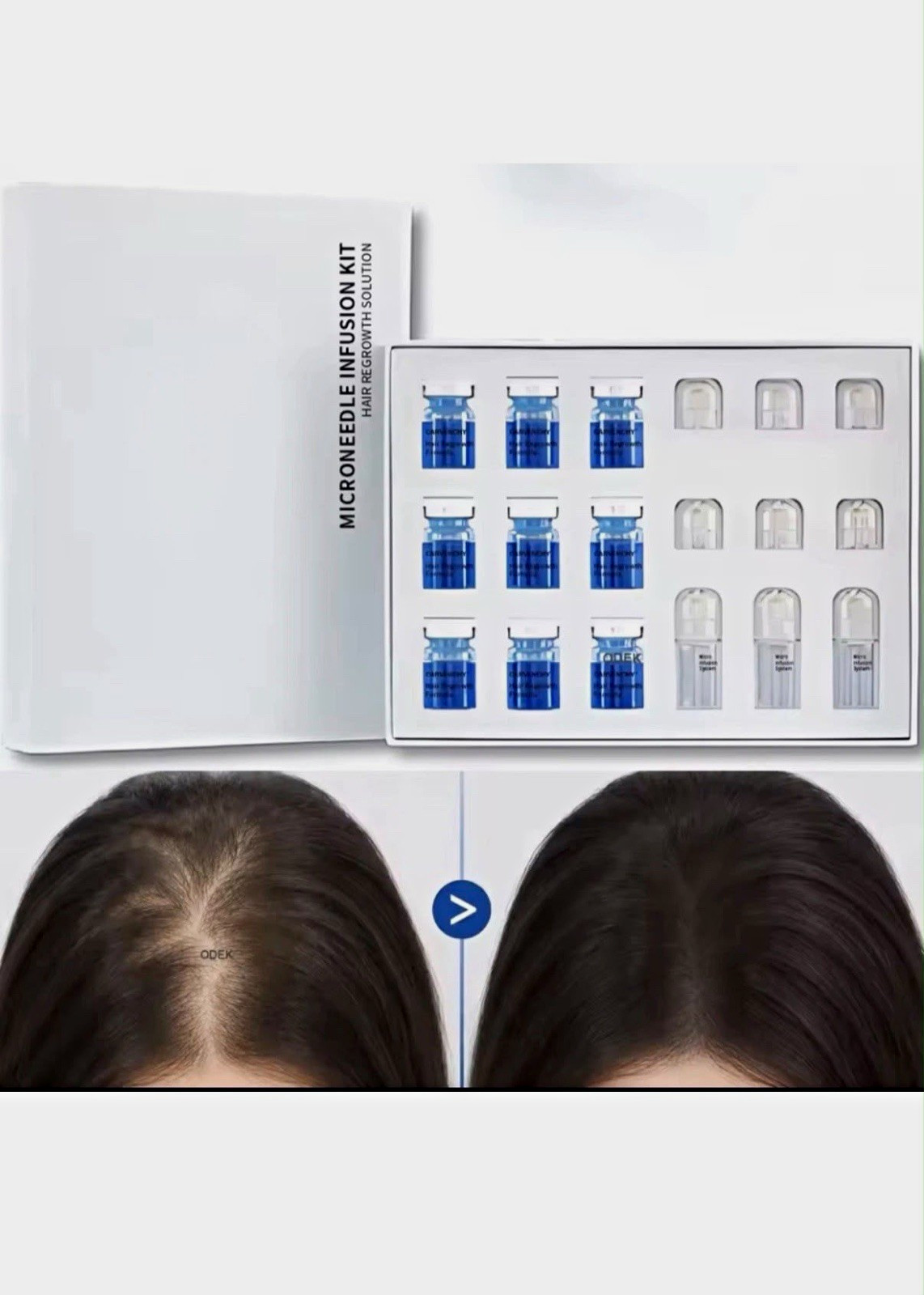 Peptonix Copper Peptide Serum System - For Fuller-Looking, Thicker-Looking Ha...