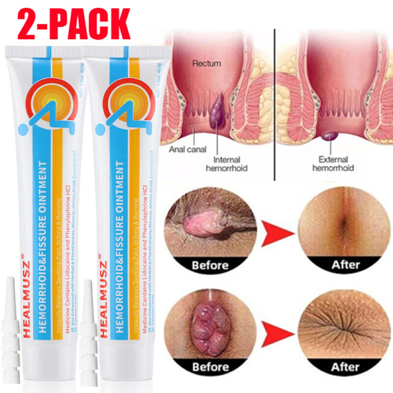2PCS Herbal Hemorrhoid Cream, Hemorrhoid Treatment, Hemorrhoid Fissure Ointment