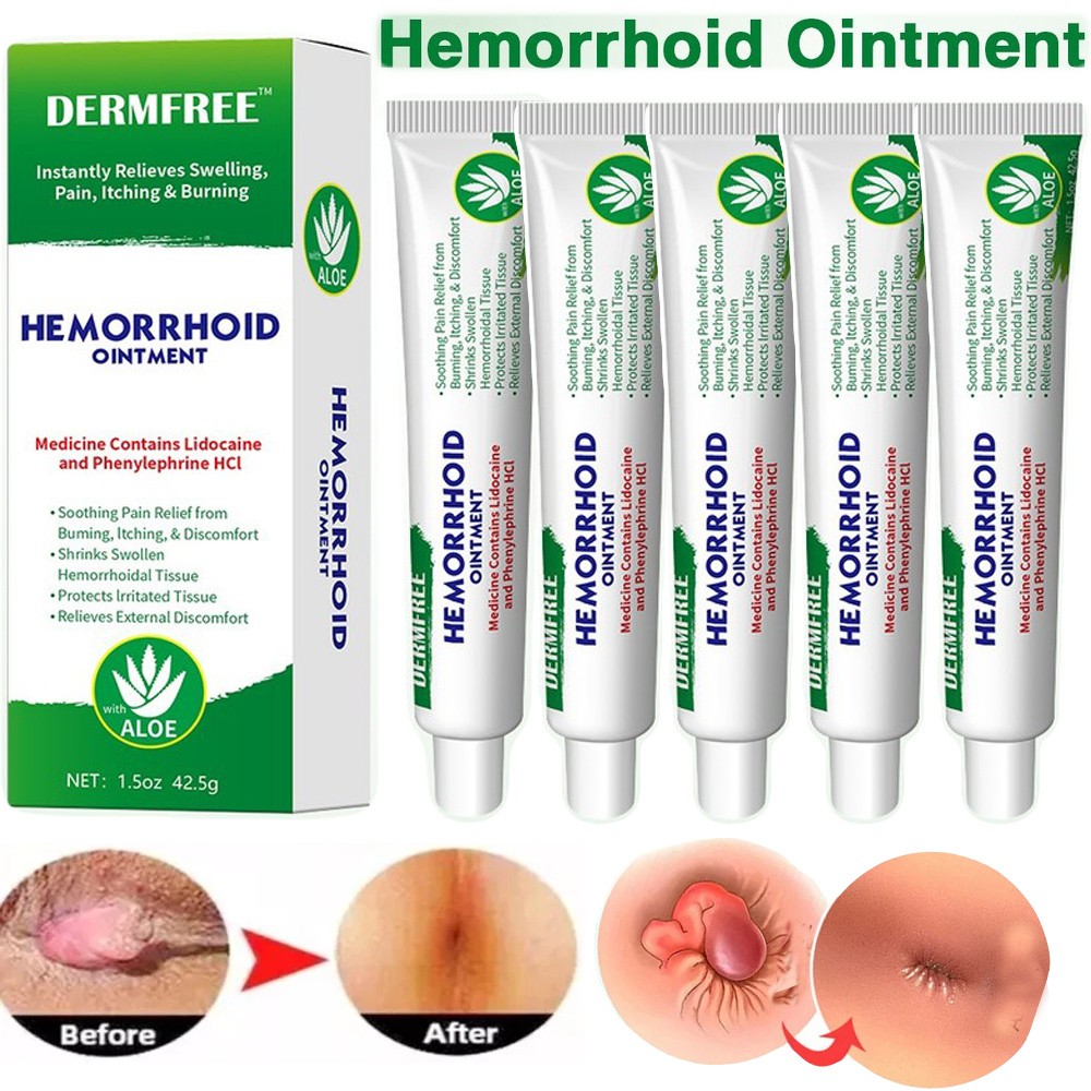 5XHemorrhoid Cream Haemorrhoids Fissure Gel Piles Anal Fissure Prolapse Ointment