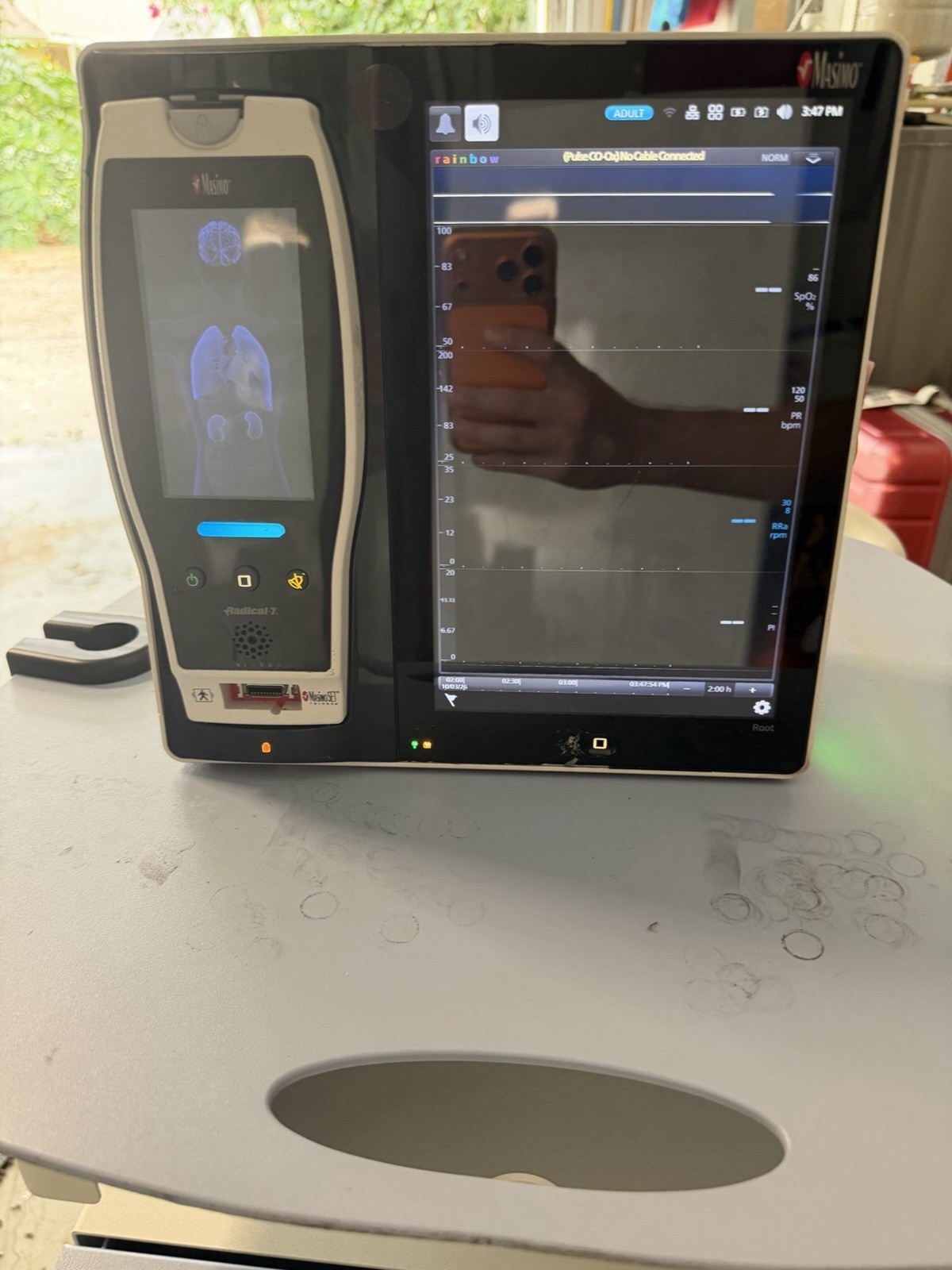 Masimo Root Monitor W/ Radical-7 Patient Monitor | fully functional | READ
