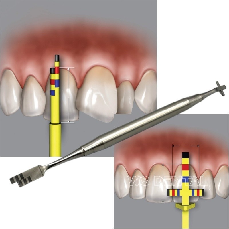 Aesthetic Teeth Crown Proportion Gauge Dental Sounding Lengthening Gauges Ruler Aesthetic Teeth Crown Proportion Gauge Dental Sounding Lengthening Gauges Ruler