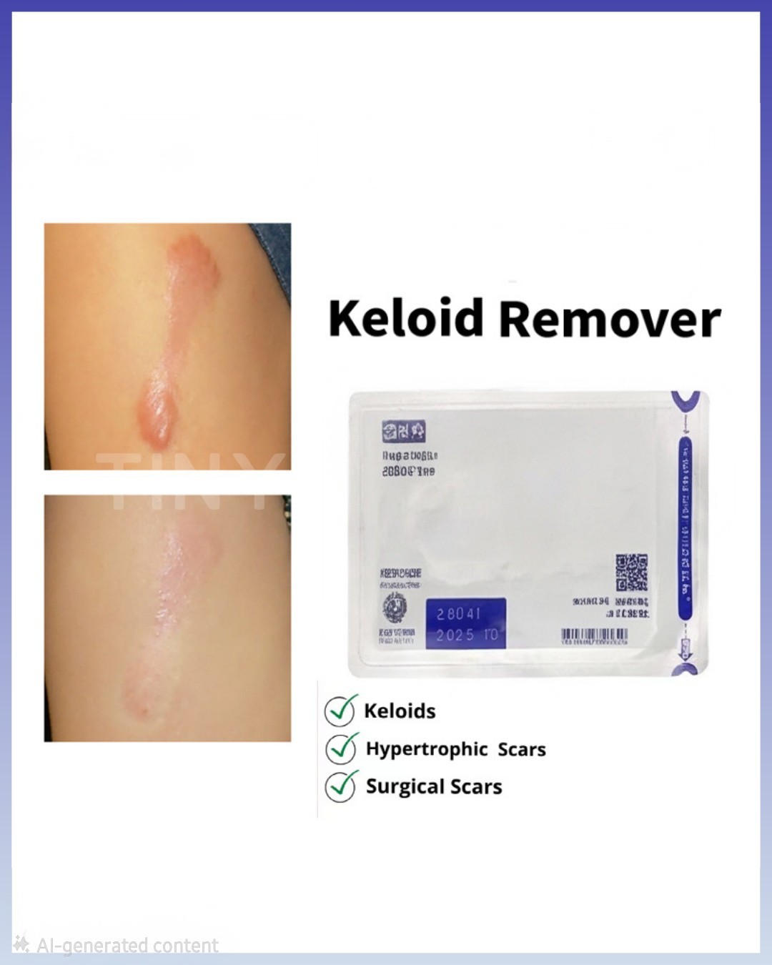 5 X sheets keloid tape Ecla Plaster 5 X sheets keloid tape Ecla Plaster