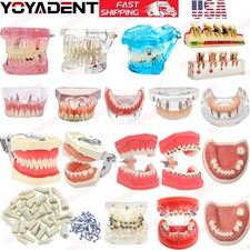 US Dental teeth Model Preparation Training Teaching Ortho Implant Typodont Demo picture