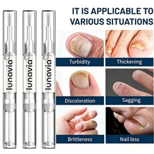3-15PCS  Lunavia Antifungal Pen, 25% Undecylenic Acid – Toenail Fungus Treatment picture