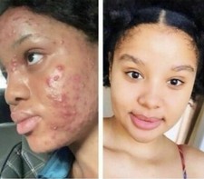 2*Skin Lightening Cream Extra Strength Lighter FAST Result-NO SIDE EFFECTS picture