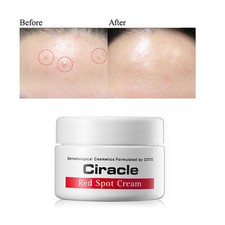[Ciracle] Red Spot Healing Cream 30ml Trouble skin Pimple Acne Anti-blemish   picture