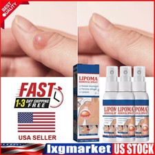 1-5PC Lipomheilung Reduction Spray,Instant LumpFree Lipoma Removal Spray USA Hot picture