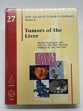 Tumors of the Liver by MD Torbenson, Michael: New picture