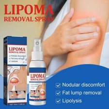 1-5PC Lipomheilung Reduction Spray,Instant LumpFree Lipoma Removal Spray USA Hot picture