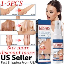 1-5PC Lipomheilung Reduction Spray,Instant LumpFree Lipoma Removal Spray USA Hot picture