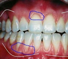 Sale Exclusive Toothpaste to Grow Gum & Stop Bleeding & Bad Breath,Parents Gift picture