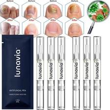 3-15PCS Lunavia Antifungal Pen, 25% Undecylenic Acid – Toenail Fungus Treatment picture