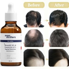 Hair Growth Topical Solution For Hair Regrowth, Reactivates Hair Follicles picture