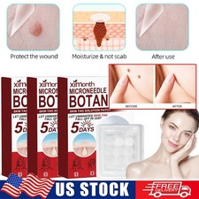 9-45 PCS Microneedle Botanic Skin Tag & Acne Patch Skin Tag Remover Patches HOT picture