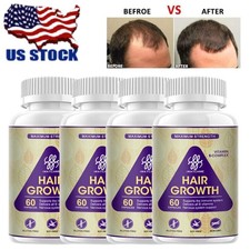 1-4PCS DHT BLOCKER HERBAL HAIR FAST GROWTH PILLS PREVENT ANTI LOSS STIMULATE picture