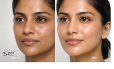 NEW Skin Lightening Cream for Smooth, Even-Looking Skin 30gm picture