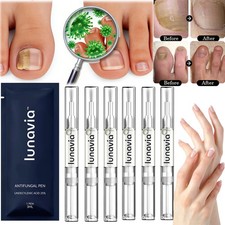 15/6/3PCS Lunavia Antifungal Pen 25% Undecylenic Acid – Toenail Fungus Treatment picture