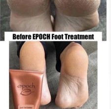 New Epoch Sole Solution Foot Treatment 4 Oz-Free Shipping picture