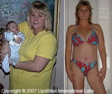 Quick Weight Loss Pills That Work Fast Belly Best Fat Burner Diet Slim Powerful picture